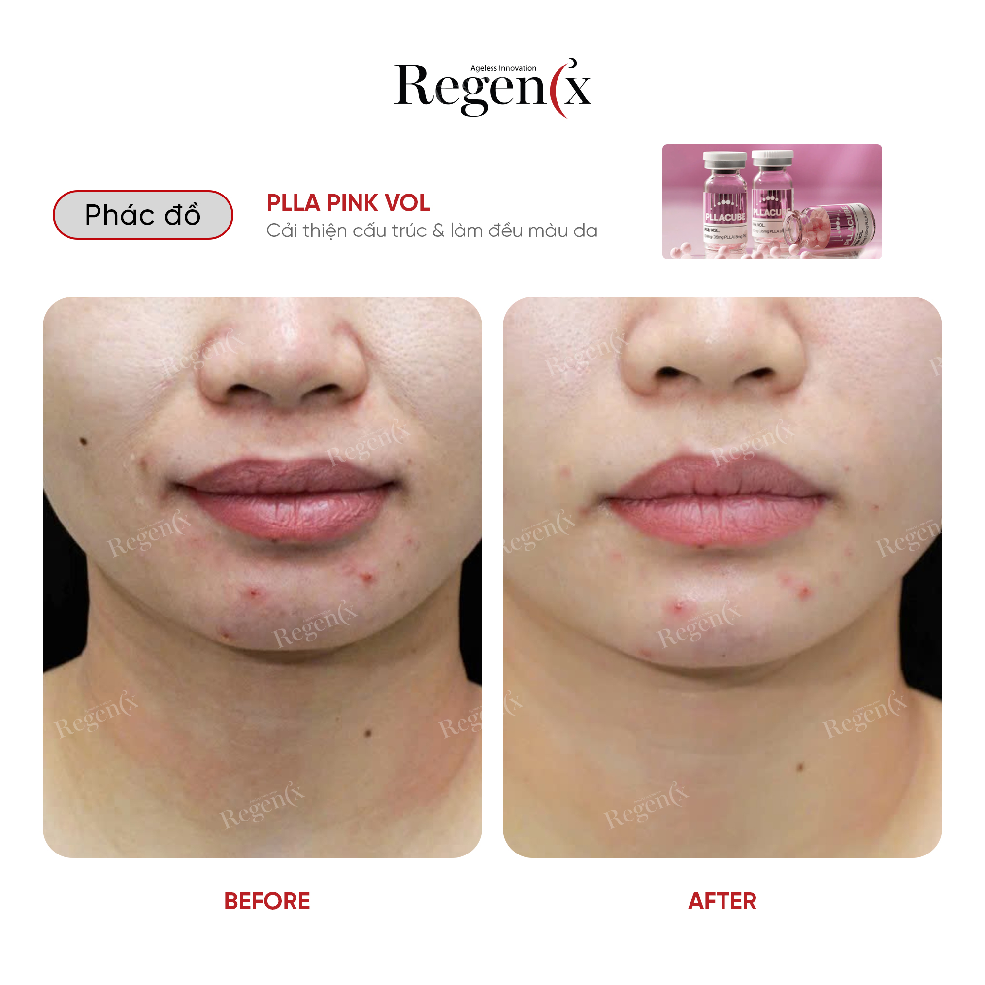 PLLA CUBE ( PINK VOL ) - TRẺ HÓA TOÀN DIỆN THẾ HỆ MỚI - Ảnh 2