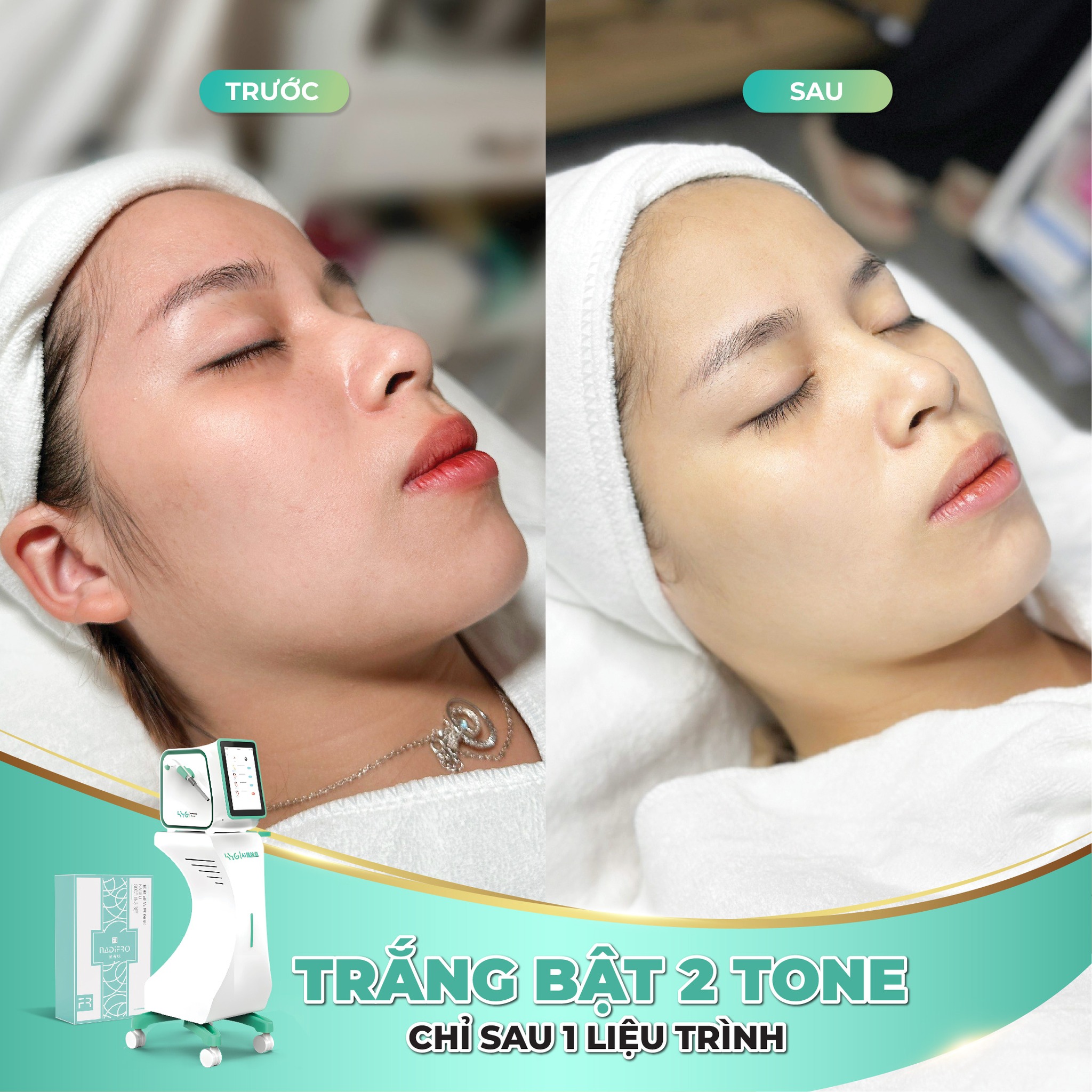 HYDRO FOAM - Ảnh 4