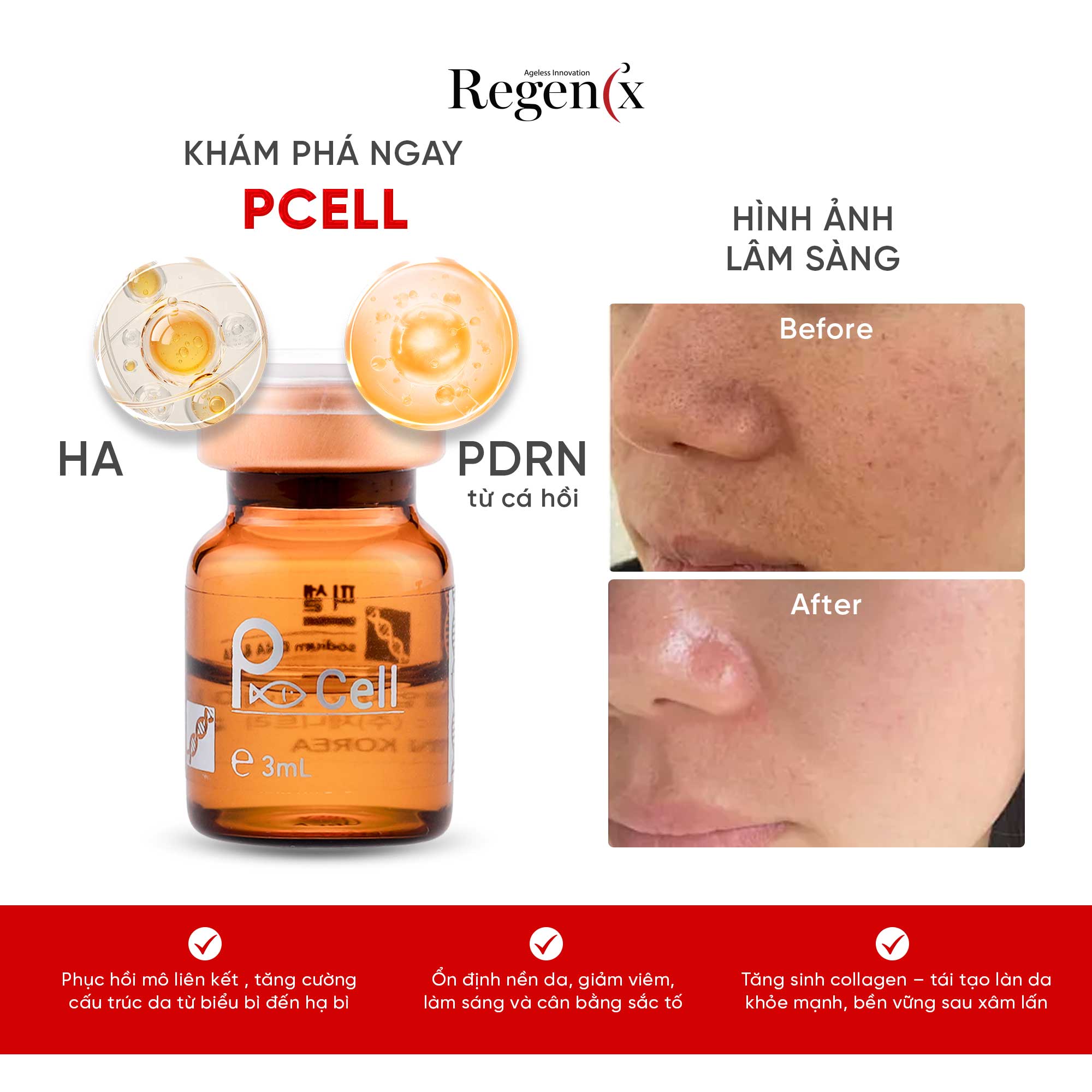 P-CELL - TRẺ HÓA LÀN DA TỪ DNA CÁ HỒI - Ảnh 3